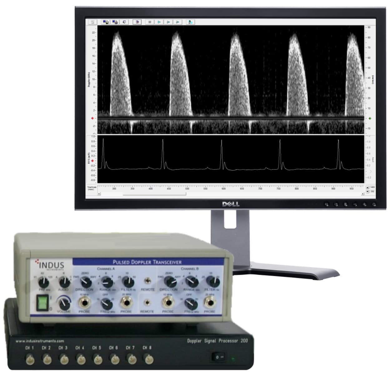 多普勒血液流速测量系统